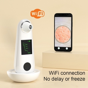 Aspirateur de pores visuel personnalisé en usine avec dissolvant de points noirs chauds et froids avec caméra HD - Product Image 5