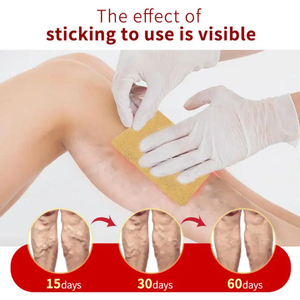 Suplemen Herbal Harga Pabrik untuk Varises, Plester Alami Meningkatkan Penampilan Kaki, Meredakan Nyeri, Manfaat Hipoalergenik - Product Image 2
