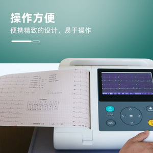 Ecg Machine Digital Filter High Precision Automatic Baseline Adjustment Portable Patient Monitor With Usb Rechargeable <b>Battery</b> - Product Image 2