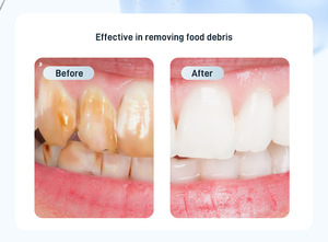 Irrigador Bucal Portátil, Limpiador de Dientes con Hilo Dental, Irrigador de Agua Portátil Mini para Limpieza Dental - Product Image 3
