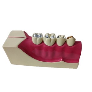 โมเดลฟัน Dt Dental รุ่น Mx-2 แบบถอดประกอบได้ พร้อมแม่เหล็ก สำหรับการเรียนการสอน ขนาด 11*4*5.3 ซม. สำหรับทำความสะอาดและอุดฟัน อุปกรณ์ทันตกรรม - Product Image 4