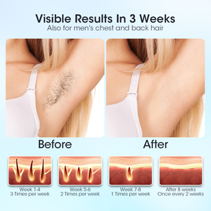 Vĩnh viễn <span class=keywords><strong>Laser</strong></span> máy cạo lông điện depilador mlay <span class=keywords><strong>Laser</strong></span> T14 IPL tẩy lông trẻ hóa da phụ nữ 17j 500000 Flash mlay Ltd. - Product Image 5