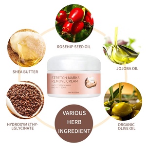 Crema Para estrías, Crema blanqueadora de la piel, Crema de eliminación de estrías, oferta de etiqueta privada - Product Image 2