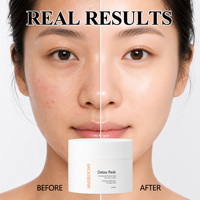 Lingettes Toniques Exfoliantes et Séborégulières Anti-Pores Dilatés à l'AHA, BHA, Hamamélis, Bakuchiol et Acide Salicylique – Offre Spéciale