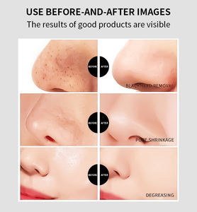 Masker Penghilang Komedo Logo Kustom Pembersih Mendalam Menghilangkan Komedo Jerawat Mengecilkan Pori-pori <span class=keywords><strong>Strip</strong></span> Hidung - Product Image 5