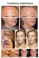 Machine faciale à écran tactile la plus vendue, stimule la production de collagène, appareil anti-rides pour le visage, idéal pour les spas