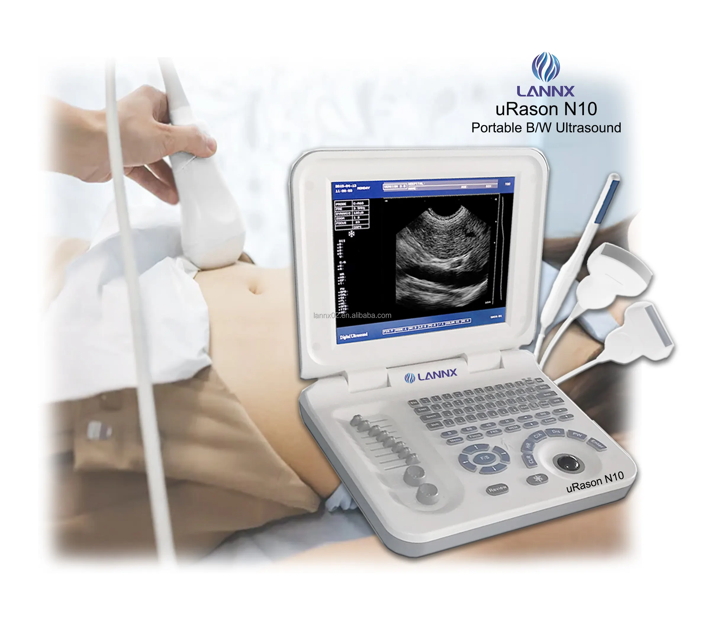 LANNX uRason N10 Hot Sales Hospital Doppler Ultrasound Scanner Sistema ultra-sônico máquina preto e branco laptop Ultrassom
