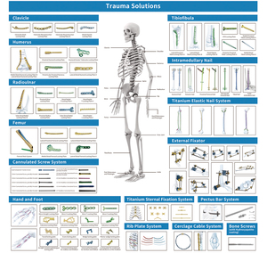 Plat Pengunci Lateral Tibia <span class=keywords><strong>Distal</strong></span> Ortopedi Geasure, Implan Titanium Kelas Instrumen III, Garansi 1 Tahun - Product Image 5