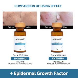 Etiqueta privada Cuidado DE LA PIEL <span class=keywords><strong>Factor</strong></span> de crecimiento epidérmico Suero facial liofilizado Hidratante firme Juego de esencia facial antiarrugas antienvejecimiento - Product Image 3