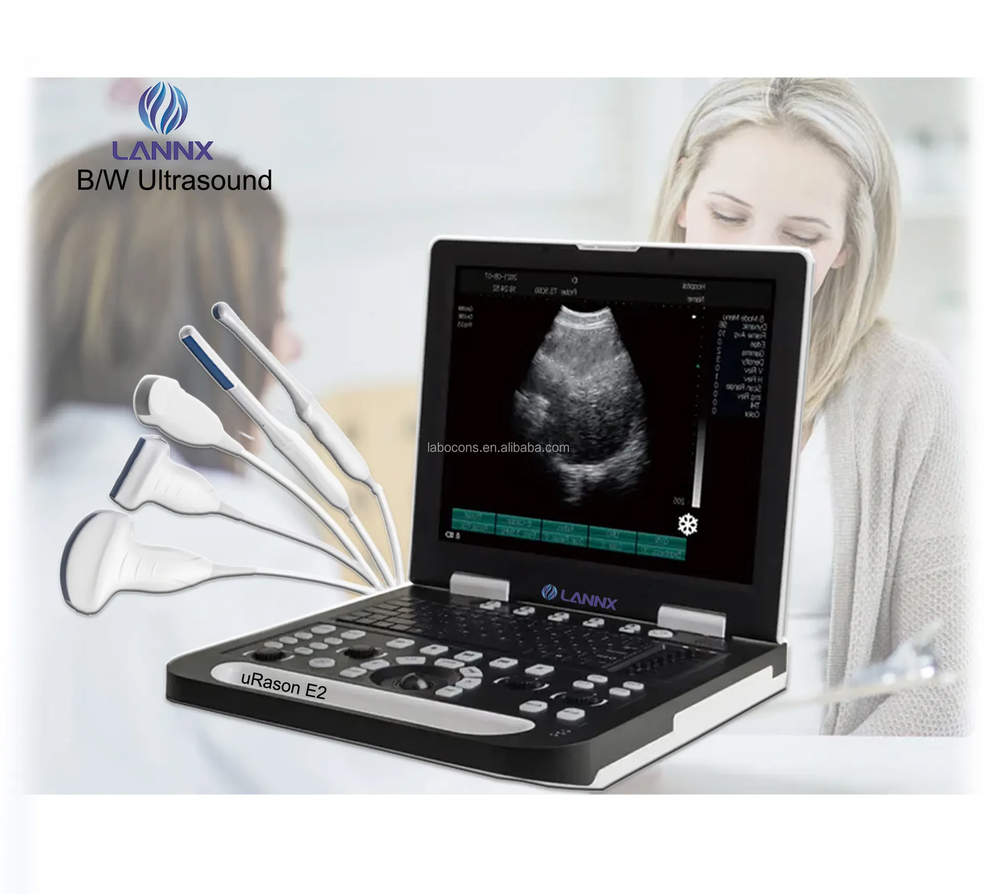 LANNX uRason E2, отличная медицинская 3D USG, полностью цифровая ультразвуковая диагностическая система, B/W, портативная ультразвуковая машина