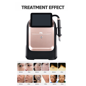 เครื่องเลเซอร์กำจัดขนแบบ Picosecond สองความยาวคลื่น 1064nm 532nm ยอดนิยม พร้อมระบบระบายความร้อนด้วยน้ำหมุนเวียน - Product Image 4