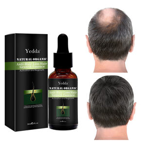 Minyak Esensial Pertumbuhan Rambut Herbal Vegan Organik Alami 100ml, Cocok untuk Karakteristik Rambut Tipis dan Mengembang - Product Image 1