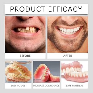 Set per Modifica Protesi Dentarie con Gel Sbiancante, Decorativo, Morbido, Delicato sulla Pelle, Confortevole da Indossare, Migliora la Texture, Sorriso Bellissimo per Uso Domestico - Product Image 2