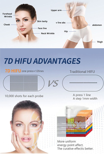 Máquina de Belleza SMAS 2026, la Más Nueva, para Lifting de Cuello y Ojos, para Salón de Belleza y Uso Doméstico - Product Image 3