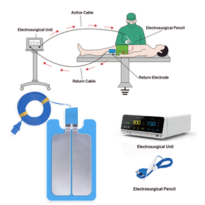 لوحة تأريض محايدة للمرضى من نوع ESU مع خاصية التعقيم بالأوزون للاستخدام الطبي للأطفال - Product Image 5
