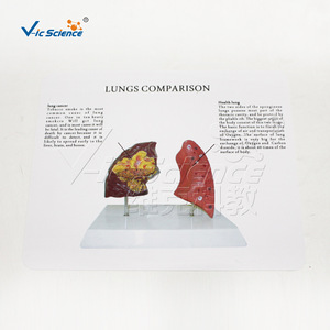 Modèle comparative des poumons normaux et des poumons de fumeurs, utilisé pour la démonstration, l'enseignement et la vulgarisation des lésions pulmonaires. - Product Image 2