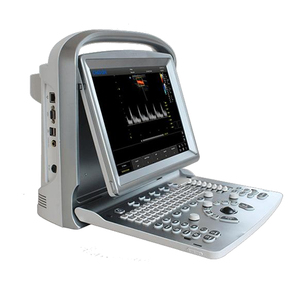 Sono Series High-End Veterinair Ultrasone Systeem 4D AI-Gestuurde Precisie Diagnostiek & Geavanceerde Workflow Volledige Lichaamsafbeelding van Huisdieren - Product Image 6