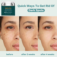 NOUVEAU Crème anti-boutons pour l'élimination des mélasmas et des imperfections Correcteur des taches foncées Blanchiment fort Blanchiment du visage Taches de rousseur Hyperpigmentation