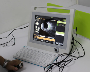 Biómetro Óptico Oftálmico AB Escáner Oftálmico Ultrasonido <span class=keywords><strong>Oftalmólogo</strong></span> Biómetro Paquímetro - Product Image 6