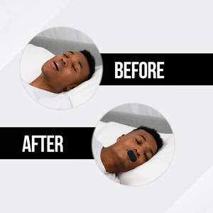 Parche para Dejar de Roncar, Corrección de la Respiración Nasal, Mejora el Sueño, Promueve una Mejor Respiración, Cinta de Ortodoncia Bucal Portátil para Dormir por la Noche - Product Image 5