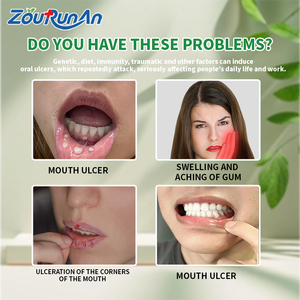 สเปรย์บรรเทาอาการปากแผลในปาก30มล. แผลในช่องปากฟันผุเลือดออกเหงือกเพื่อบรรเทาทำความสะอาดปาก - Product Image 3
