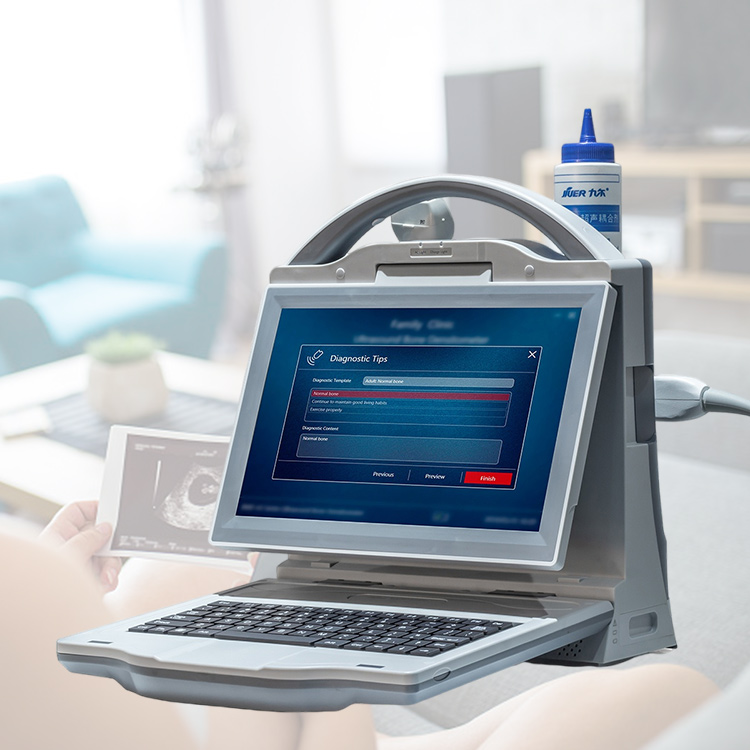 Escáner de densidad ósea médica portátil Máquina densitómetro óseo por ultrasonido