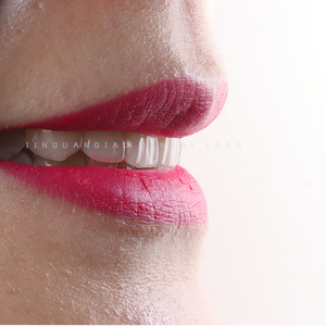 Carilla de cerámica de porcelana para dentaduras postizas de alta calidad, personalización privada para el cuidado <span class=keywords><strong>dental</strong></span>, recuperación oral - Product Image 5