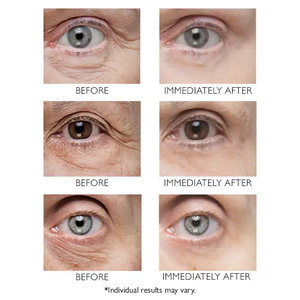 Lance Private Label Eye Temporary Eye Tightener <span class=keywords><strong>Acide</strong></span> <span class=keywords><strong>hyaluronique</strong></span> Niacinamide Sans huile pour raffermir <span class=keywords><strong>les</strong></span> poches et <span class=keywords><strong>les</strong></span> <span class=keywords><strong>rides</strong></span> <span class=keywords><strong>sous</strong></span> <span class=keywords><strong>les</strong></span> <span class=keywords><strong>yeux</strong></span> - Product Image 3