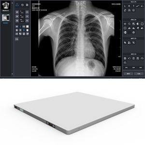 Rilevatore a schermo piatto medicale wireless 17*17 <span class=keywords><strong>imaging</strong></span> digitale senza pellicola di lavaggio macchina a raggi X dedicata - Product Image 2