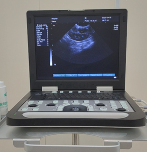 MC1000Vet Smart ARM Sistema de ultrasonido Escáner de ultrasonido veterinario portátil Usg para criadores de perros - Product Image 2