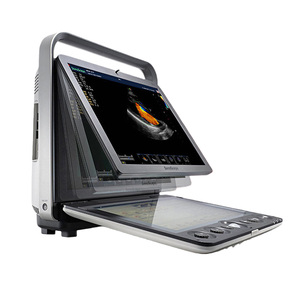 Ecógrafo Veterinario Profesional Sonoscape S9V para Exámenes Abdominales, Cardíacos y Vasculares Completos, Reutilizable - Product Image 4