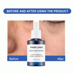 เซรั่มบำรุงผิวหน้า Zero Pore Overnight Resurfacing พร้อมสารสกัดกระชับรูขุมขน-AHA+BHA+PHA ไนอะซินาไมด์ ควบคุมความมันบนใบหน้า - Product Image 5