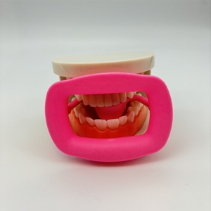 Écarteur buccal en silicone en forme de O pour blanchiment des dents, rétracteur de lèvres et de joues dentaire - Product Image 5