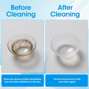 ขวดสารละลายน้ำเกลือสำหรับทำความสะอาดคอนแทคเลนส์แบบไม่ใช้สารกันบูดใช้ครั้งเดียวฉลากส่วนตัว - Product Image 5