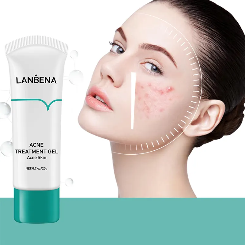 LANBENA-tratamiento nutritivo natural para el acné, solución para eliminar el acné, gel