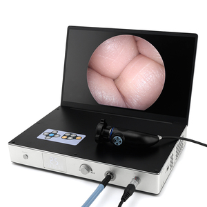 Sistema médico de cámara Full HD 4 en 1, sistema de imagen endoscópica portátil de 15,6 pulgadas 1080P para laparoscopia/ENT/artroscopia quirúrgica - Product Image 1