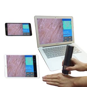 Analyseur intelligent de peau et de cuir chevelu HD 1080P 5G wifi <span class=keywords><strong>Dermatoscope</strong></span> numérique WiFi sans fil à vendre - Product Image 3
