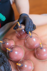 Offre Spéciale – Kit de Ventouses Jetables en Plastique PC/AS – Ventouses Hijama en ABS – Tailles du 1 au 8 – Équipement de Ventouses Individuelles - Product Image 6