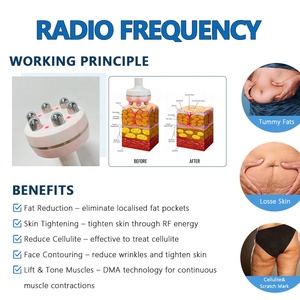 Rouleau de massage radiofréquence anti-<span class=keywords><strong>cellulite</strong></span> pour spa et salon - Product Image 5