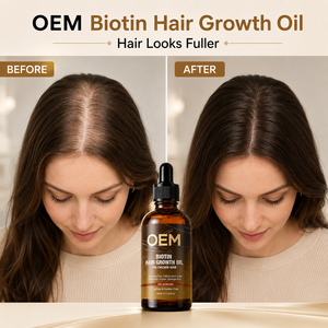 Aceite fortalecedor del cabello con biotina para el crecimiento del cabello y volumen, OEM Professional Boosting, sérum para el cuero cabelludo para hombres y mujeres con cabello fino. - Product Image 1