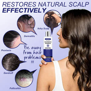 Champú de 250 ml para el Tratamiento de la <span class=keywords><strong>Dermatitis</strong></span> Seborreica, Anticaspa y Antipicazón, Alivia el Cuero Cabelludo Seco y con Picazón, Champú para la Foliculitis - Product Image 4