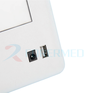 घोड़ा अल्ट्रालाइट हैंडहेल्ड पोर्टेबल पशु चिकित्सा 10 घंटे बैटरी जीवन फ्लैट पैनल डिटेक्टर डिजिटल एक्स-रे मशीन - Product Image 4