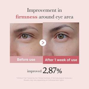 Suero para Ojos con Resveratrol, Ácido Tranexámico y AHA para Salmón, 99% de Pureza, Vegano, para Todo Tipo de Piel, Ojeras, Líneas Finas, Tono de Piel - Product Image 4
