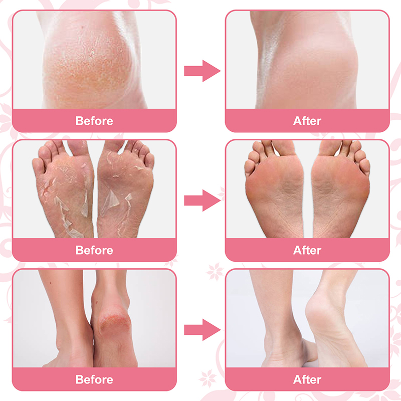 wholesale custom fruits natural foot mask sock peeling moisturizing exfoliating rose foot peel mask