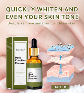 Enjoy Skin Wholesale Sérum blanchissant foncé pour enlever les taches noires Sérum éclaircissant pour les doigts - Product Image 4