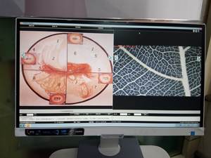 CE diakui optikal portabel vagina koloskop untuk ginekologi kernel colposkopik kamera ccd seluler koloscopie dalam klinik - Product Image 6