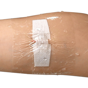 Échantillon gratuit de pansements adhésifs médicaux en forme de papillon avec fermeture à glissière fournisseur d'usine de bandages - Product Image 1