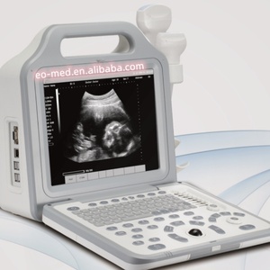 Système d'échographie diagnostique noir et blanc pour hôpitaux, usage humain, obstétrique et gynécologie, transducteur ultrasonore BW21B - Product Image 3