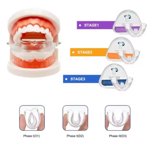 Aligneur orthodontique transparent personnalisé en TPE pour les dents - Dispositif médical de classe I certifié CE, polyvalent pour diverses applications dentaires - Product Image 1