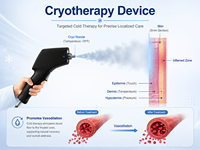 Appareil de cryothérapie professionnel directement de l'usine avec conception portable et technologie de pulvérisation de froid avancée pour usage vétérinaire